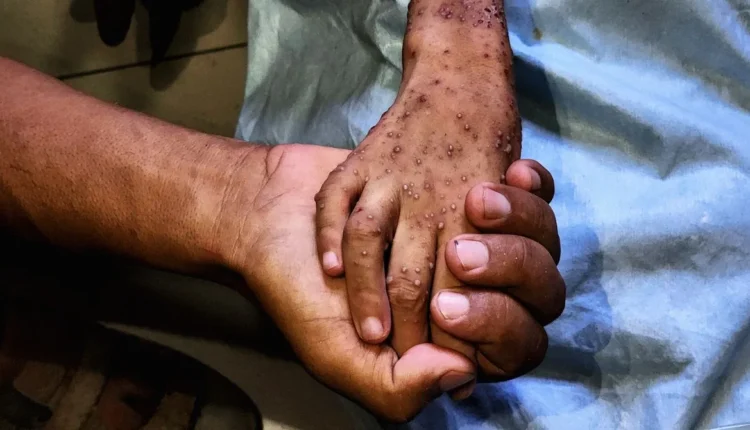 Υποσιτισμός στη Γάζα: Μια Κρίση με Μακροχρόνιες Επιπτώσεις για τις Επόμενες Γενιές