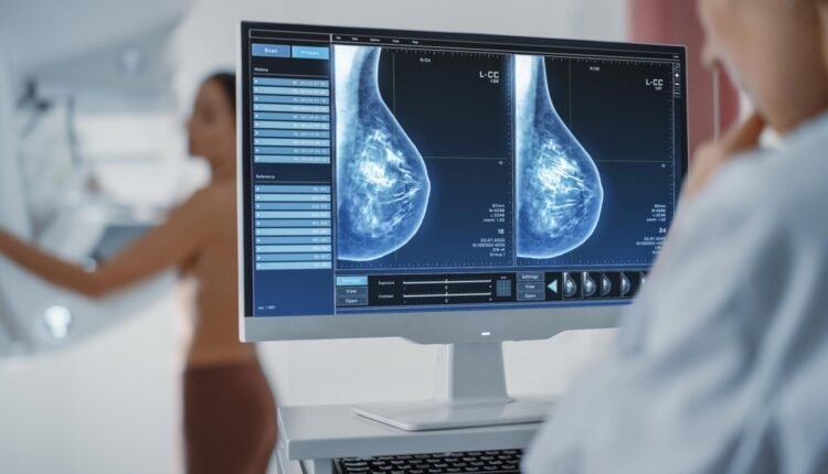 Καρκίνος του Μαστού: Η Ανακάλυψη που Σταματά την Υποτροπή