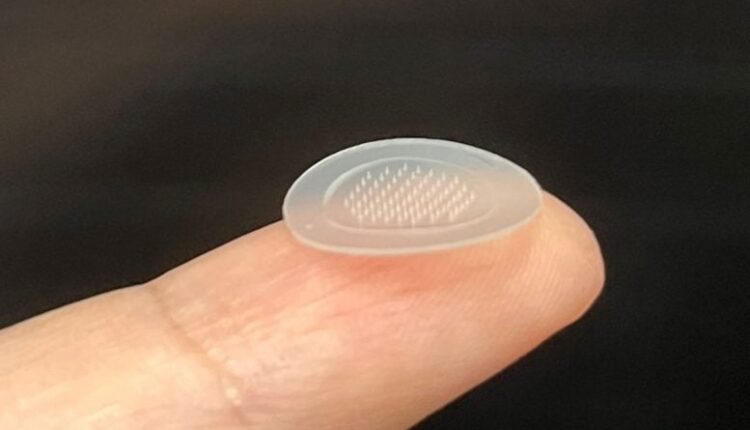 New Smart Pimple Patch Clears Acne in Just 7 Days