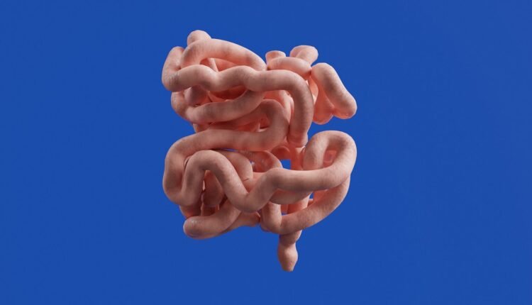 The image shows the human small intestine.