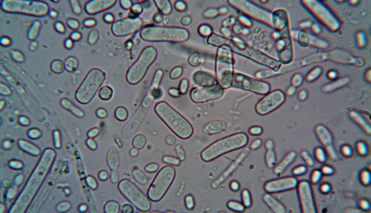 Close-up image of rod-shaped bacteria under a microscope, showcasing microscopic detail.