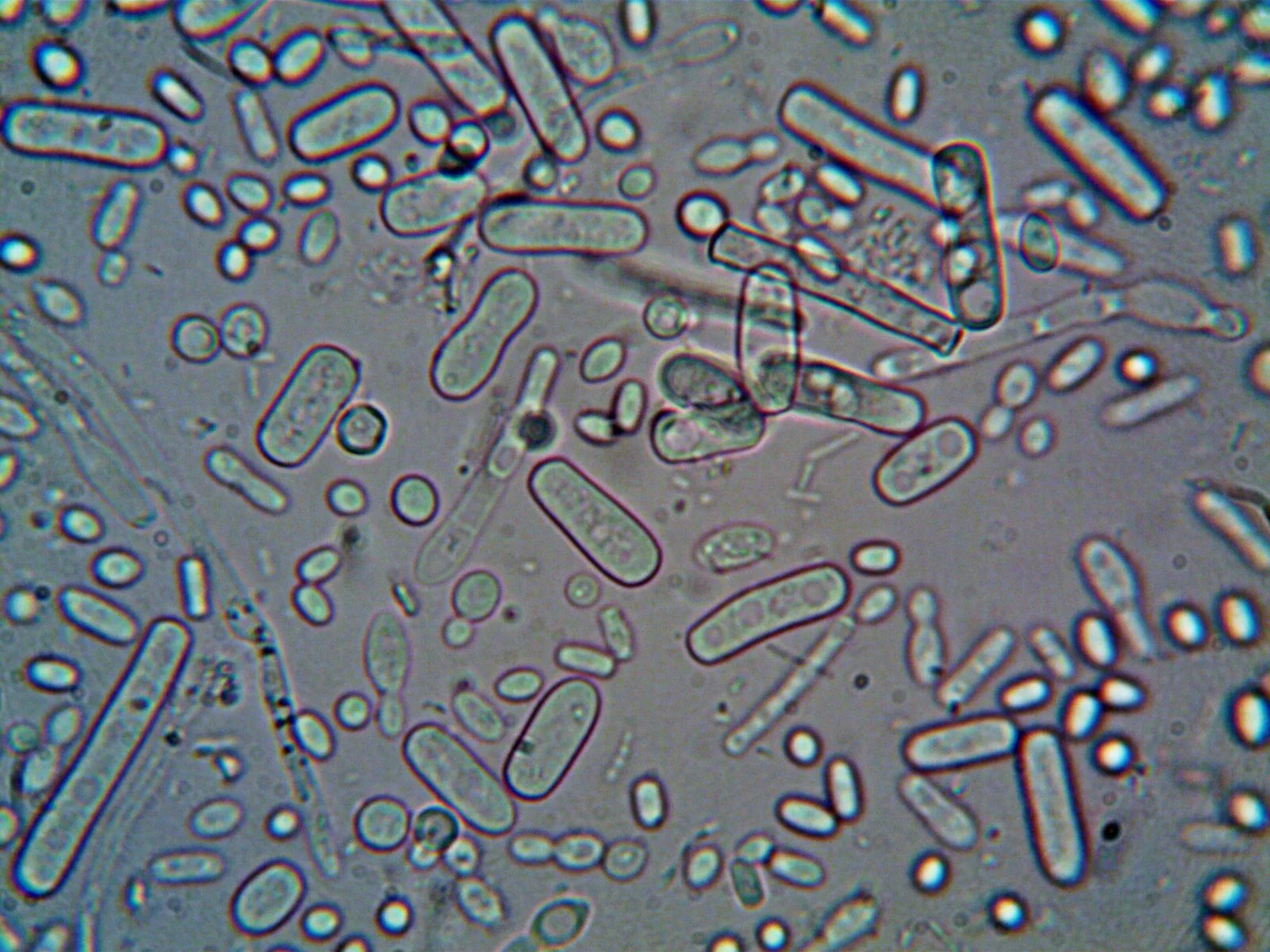 Close-up image of rod-shaped bacteria under a microscope, showcasing microscopic detail.