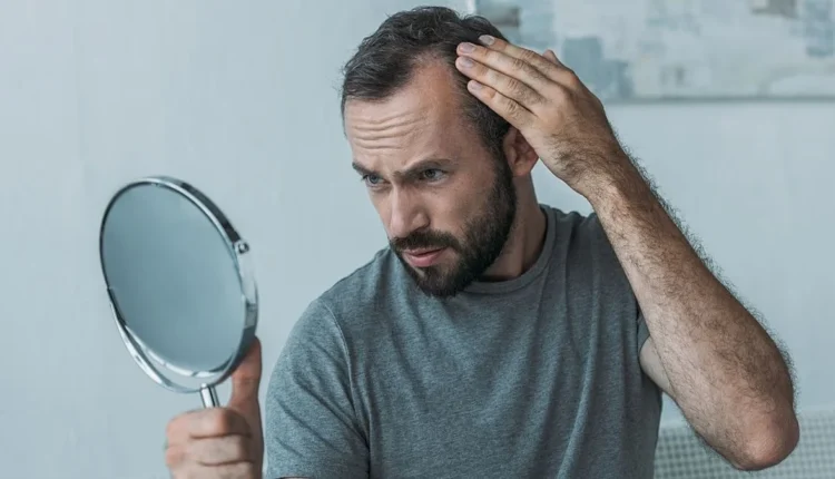 Φάρμακα για την παχυσαρκία και κίνδυνος για τριχόπτωση