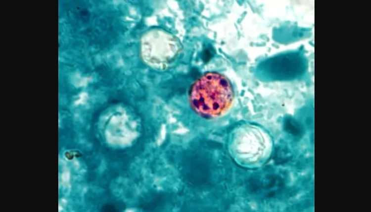 Επιδημία Cyclospora: Τι πρέπει να ξέρετε για το μολυσμένο μαρούλι