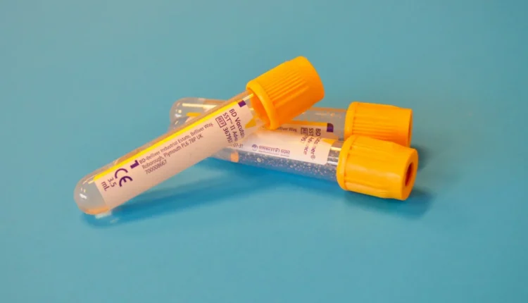 white and orange plastic tube