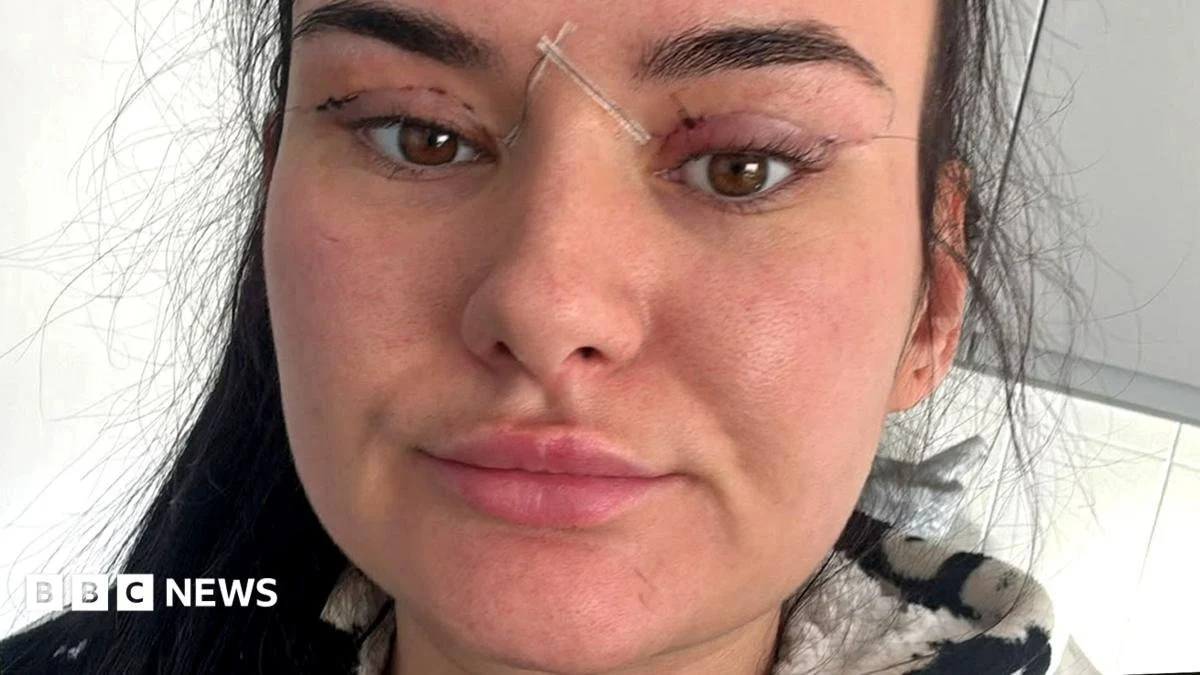 Blepharoplasty: Οι κίνδυνοι από τις φθηνές επεμβάσεις