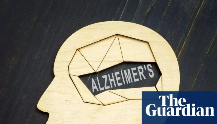 Alzheimer: Νέα κλινική δοκιμή προλαμβάνει την άνοια πριν τα συμπτώματα