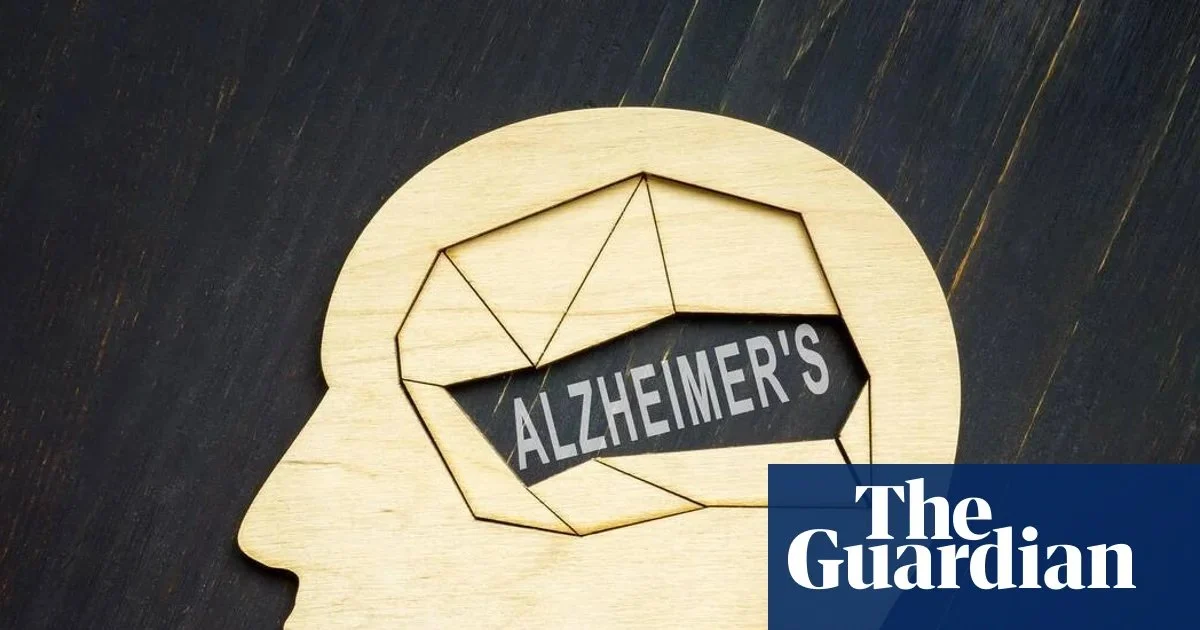 Alzheimer: Νέα κλινική δοκιμή προλαμβάνει την άνοια πριν τα συμπτώματα