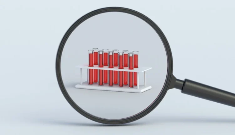 Multi-cancer blood test: Τι πρέπει να γνωρίζετε για το τεστ