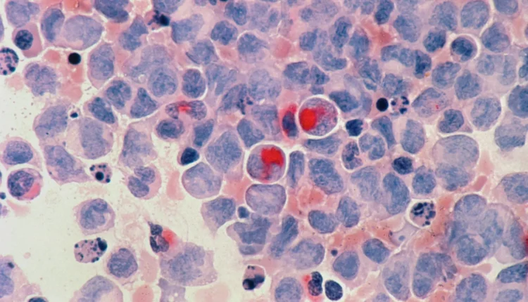 Microscopic view of stained cells with prominent red inclusions in a blue field